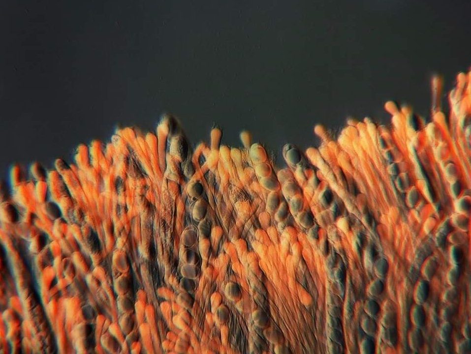 Beyaz Semer Mantarı- Helvella crispa Mikroskopta hücre görünümü
